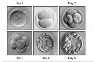 blastocyst zygote embryo embryos fertilization vitro ivf grading transfer comprendre classement embryons