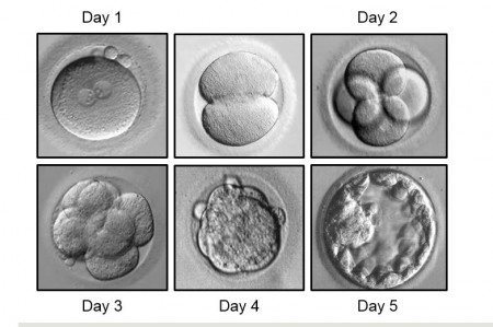Embryo development Day 1 to Day 5