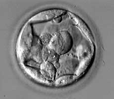 2BC embryo