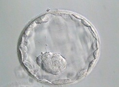 Day 5 blastocyst – pre-hatching