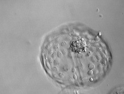 Day 5 blastocyst – hatched