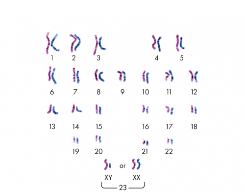 Karyotype of normal chromosome