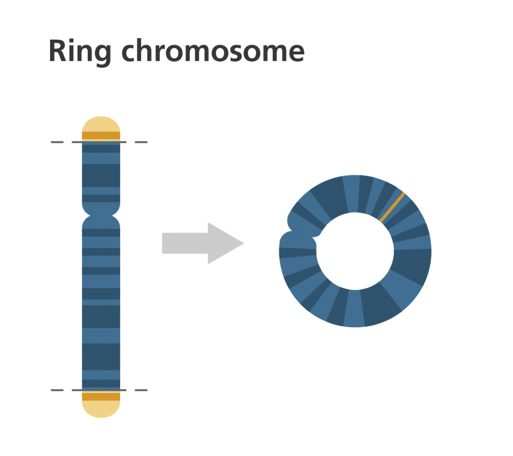 Ring chromosome